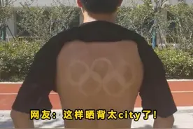 为了「治大病」，晒背族在三伏天占领公园图片