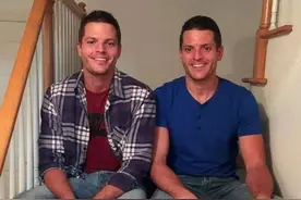 双胎兄弟肤色迥异，弟弟“被迫”给哥哥输血图片