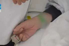 男子口吐白沫，一查两肺全白了，竟是因为这个习惯！冬天洗澡要注意图片