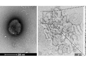 和流感相似？HMPV来势汹汹，普遍易感！图片