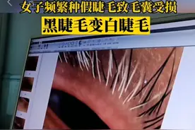 过年爱美“三件套”，当心爆火的它暗藏“陷阱”图片