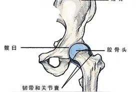 人工关节降价，换关节后能否运动自如？图片