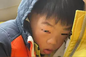飞机上男孩突然眼睛肿成核桃！同机中医5分钟急救脱险图片
