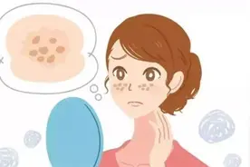 有“痣”青年看过来，点痣后需要注意的问题都在这里图片