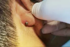 警惕！这个“黑点”又来了图片