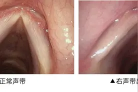 春节期间嗓子痛、声嘶，居家护理看过来图片