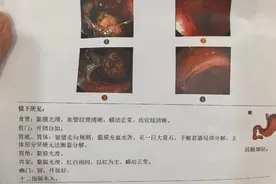 女子连“炫”30多颗山楂后胃痛难忍，医生竟让多喝可乐？图片