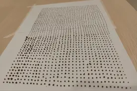 1791颗！像生姜、像豆粒，医生惊呆了：男子体内都是这些……图片