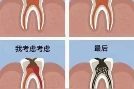 做根管治疗，真的会痛得怀疑人生吗？图片