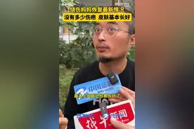 烧伤妈妈脸上的皮肤快长好了，丈夫：像是破茧成蝶，前一天还全是痂面图片