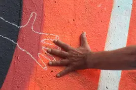 帕金森病新希望！干细胞疗法能否实现治愈？上海医生详解图片