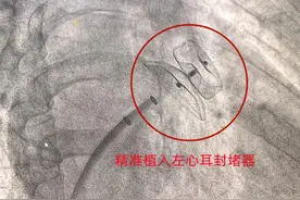 每天喝半斤白酒，七旬爹爹诱发脑梗险丢命图片