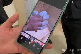 无痛觉不出汗，反复骨折啃咬手指！姐妹俩同患这种罕见病……家人崩溃图片