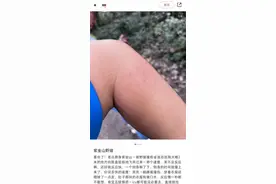 游客称爬南京紫金山走野路被野猪撞伤，管理方：很罕见图片