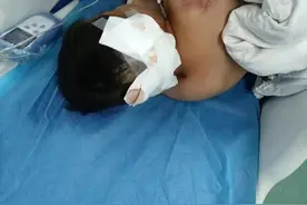 湖南邵阳10岁男童放学途中被狗咬伤，事发农村地区未禁养大型犬图片