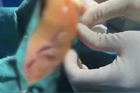 亲历者讲述广西北海不明鱼类伤人细节：有人被咬后徒手掰开鱼嘴，短短几分钟内十余人受伤图片