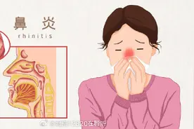 从中医角度看，过敏性鼻炎常见哪些类型？图片