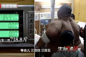 冲上热搜！718斤“中国第一胖”，半年狂减300斤图片
