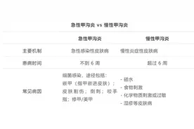 剪指甲的一个小习惯，可能导致甲沟炎反复发作图片