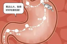 有医说医丨四类打嗝警惕胃癌信号图片