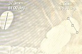 宠物狗误食20多颗石头，医生建议开刀，狗主人：已经拉出10多颗，目前健康图片