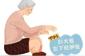 沉默的杀手——下肢深静脉血栓，你知多少？图片