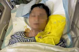 海南3人吃癞蛤蟆中毒致1死 癞蛤蟆黏液有剧毒不可随意食用图片