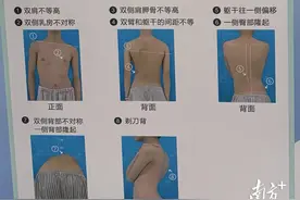 孩子高低肩、驼背、坐姿不正，要当心脊柱侧弯！图片