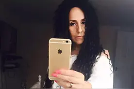 英国53岁女子为救狗冲进火场 全身50%烧伤昏迷三个月图片