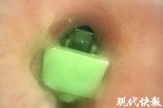4岁娃陡然呼吸困难双手掐脖子满脸通红 大夫发现玩物卡在气管