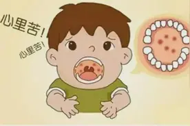 说到此病，你是不是分不太清它和手足口病的区别？图片