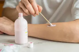 5种被夸大的皮肤科“神药”，很多人还在乱用！快自查！图片