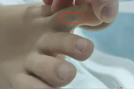 官方介入调查“27岁女子三亚旅游疑被不明物咬伤身亡”事件 家属：未来有考虑尸检图片