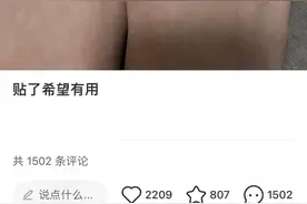 贴正甲片、修V口、塞棉花，真能让趾甲不往肉里长吗？|网红说法求真图片