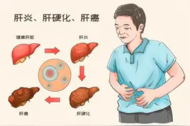 当“乙肝歧视”撞上科学治愈的曙光 他们不用再躲藏图片