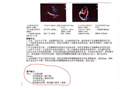 女孩身患四种先心病，却互相“修复”  ，心内科医生感叹：生命有时候，很神奇图片