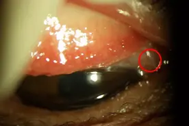 “4条活的，还在蠕动”！男子吓懵，一个动作害了他图片