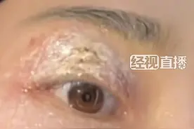警惕这种小虫！千万别拍图片