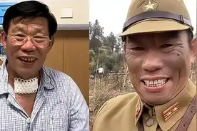 《亮剑》演员确诊甲状腺癌：以为是普通结节，导演提醒才知道是癌症图片