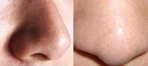 精致白领回老家，如何赢过村里王姨