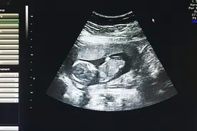 夫妻吵架致妻子胚停，医生盘点胚停原因图片