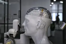 低至996元!脑机接口进入医保定价时代，真正的产业竞赛刚刚开始!图片