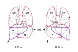 发生率百万分之一！海南一女子竟是罕见“镜面人” 手术要“反向做”图片