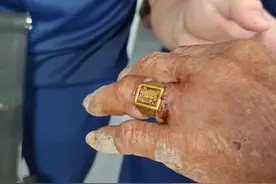 心疼！爷爷戴了多年的戒指嵌入血肉！卡手的它要赶紧摘！图片