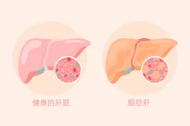 中老年人群：拒绝盲目减肥！科学减重这样做→图片