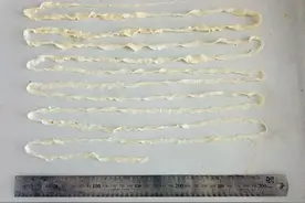 吃了这种肉 有人体内长出4米长的虫子！预防方法→图片