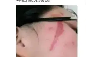 注意！这种“飞行硫酸”提前进入活跃期，千万别拍图片