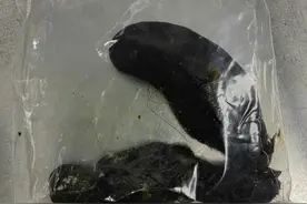 11岁女孩患上异食癖，爱吃头发快把自己拔秃了！医生提醒图片