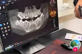 被拔错牙坠亡女子家属再发声：事发前妹妹曾多次致电当地卫健委图片