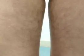 腿上长大片红斑，可能演变成癌症！这个“元凶”，很多贵州人家都有图片